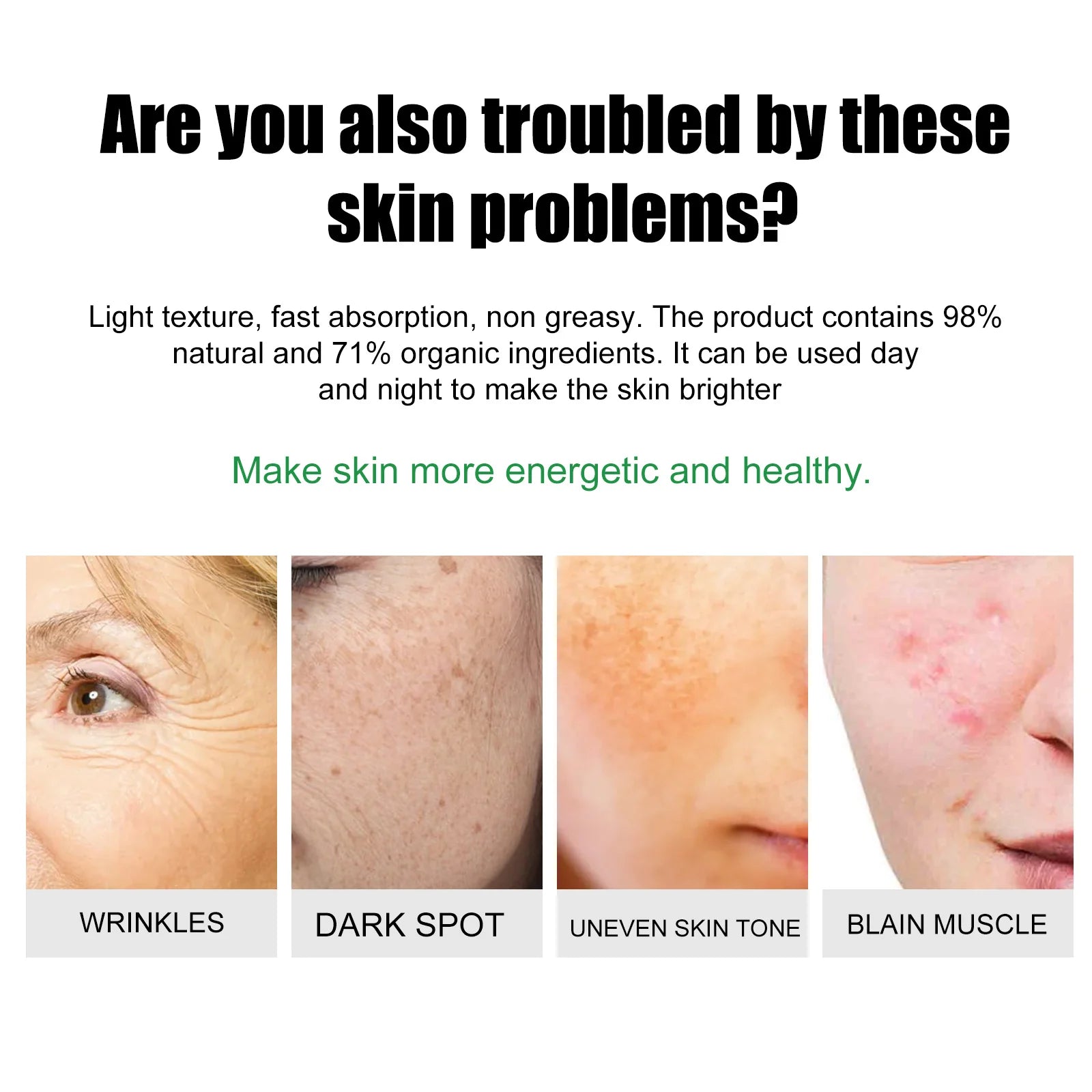 EELHOE Blemish & Acne Treatment Cream Brightens Skin Tone Hydrates & Repairs Complexion
