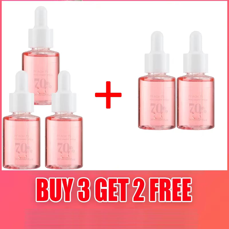 Niacinamide Dark Spot Corrector Serum – 30ml  Melanin Fading • Melasma Treatment • Pore Refining • Hyaluronic Acid Hydration